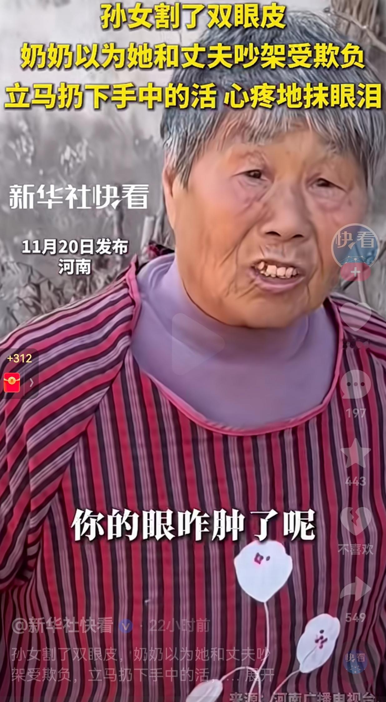 不要跟你亲近的人开这种玩笑？近日，河南一女子割了双眼皮，肿着眼回了娘家，奶奶看到