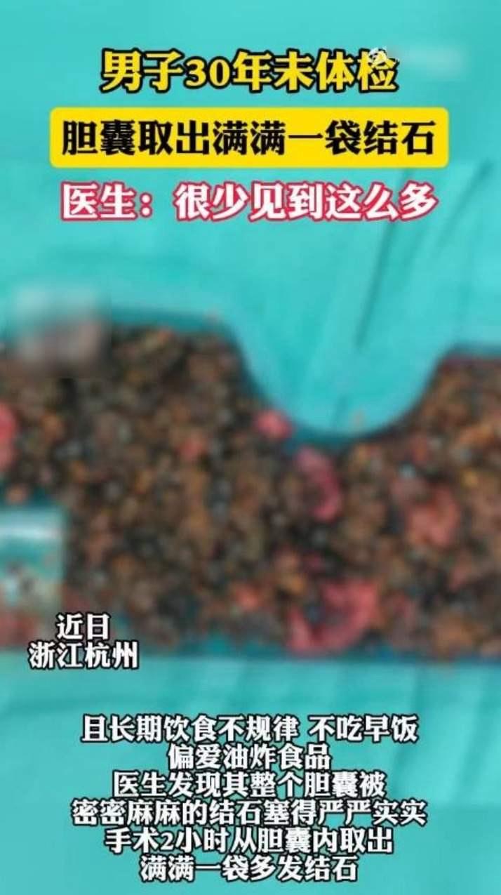近日，浙江杭州。50岁的李先生被紧急送医。他有近30多年未进行过系统体检，饮食不