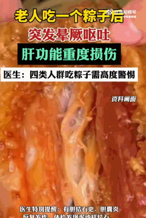 “真是病从口入！”6月17日报道，一位阿姨在端午节前夕不过是吃了个香喷喷的粽子，