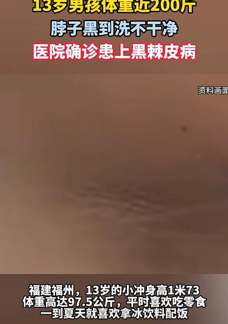福建，13岁男孩身高1米73，家人以为他能长1米9，不料，男孩的体重却高达97.