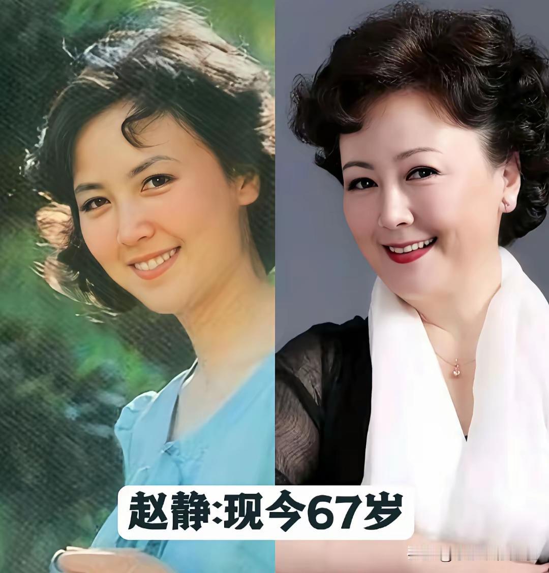 年轻时候的潘虹，这精致的五官加上深邃的眼眸，真好看！现在的潘虹给人的感觉到总是一