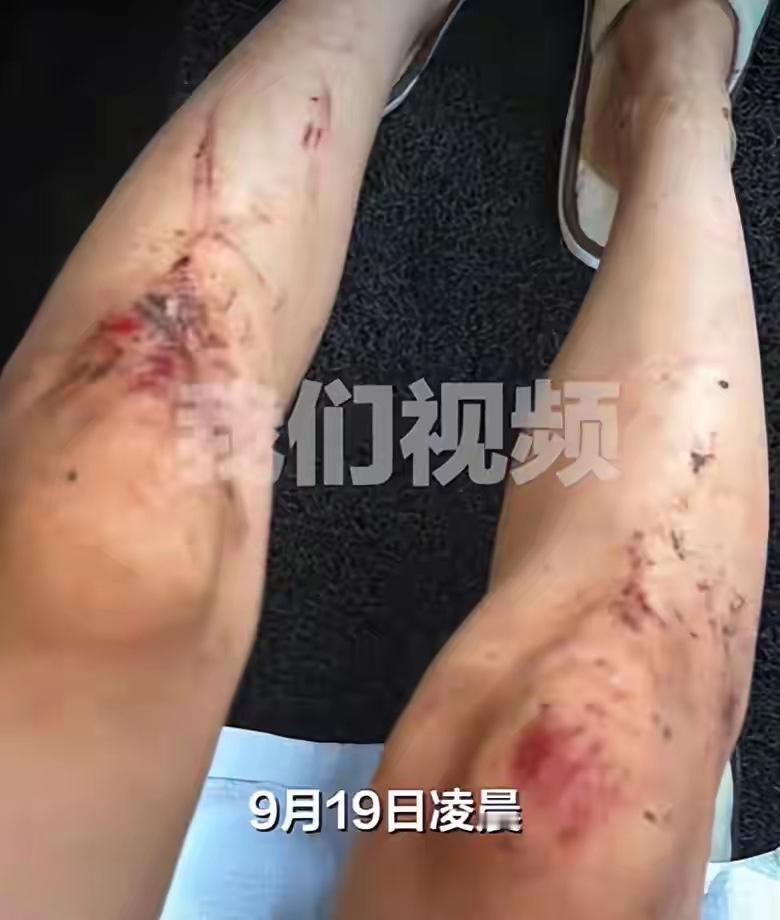 “心真大！”25岁女子独自跑去马来西亚仙本旅游。一日凌晨时分，她独自在度假村房间