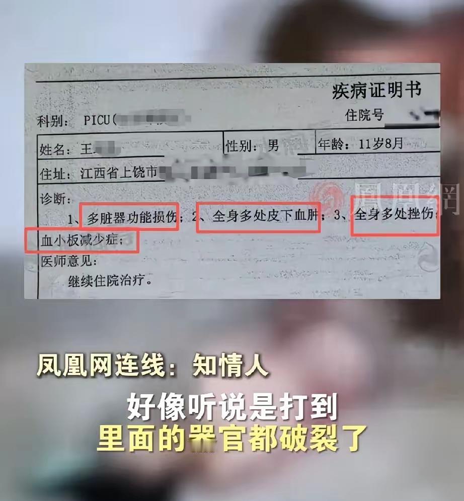 太揪心了!江西上饶那11岁零8个月的孩子,就因为长期被五六个同学霸凌,被打得内脏