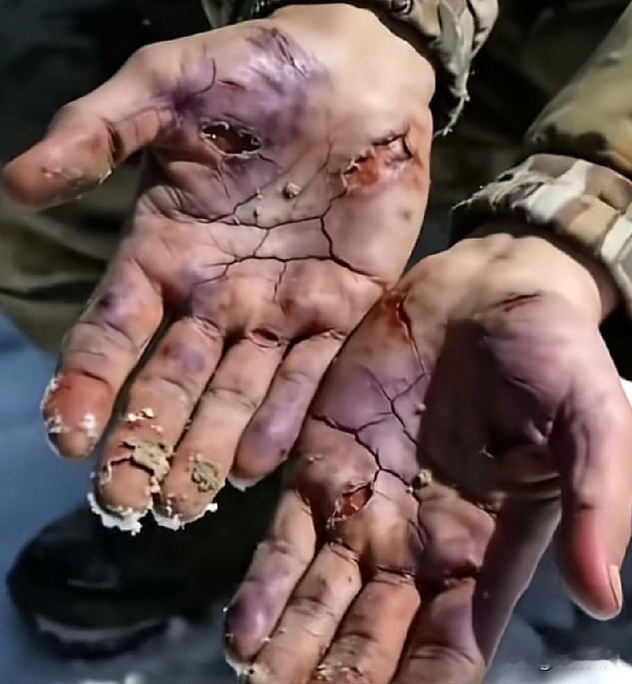 这双手看到之后让人震撼，不知道这是AI生成的画面，还是现实中真有这样的双手，这个