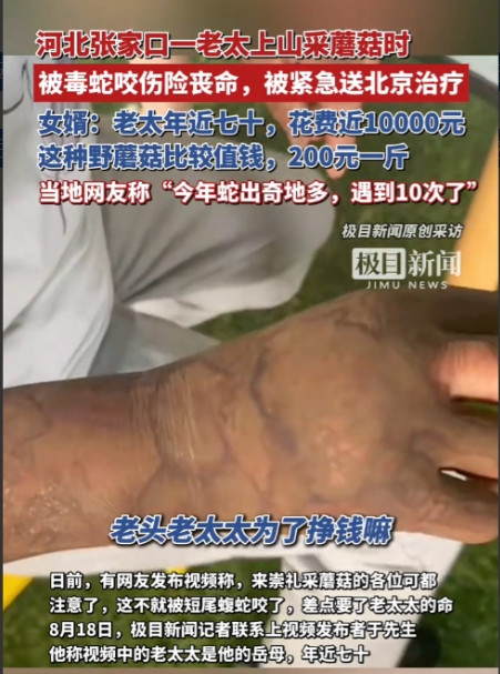 “悲剧还是发生了！”8月15日，河北张家口，一老太上山采蘑菇时，意外被毒蛇咬伤手