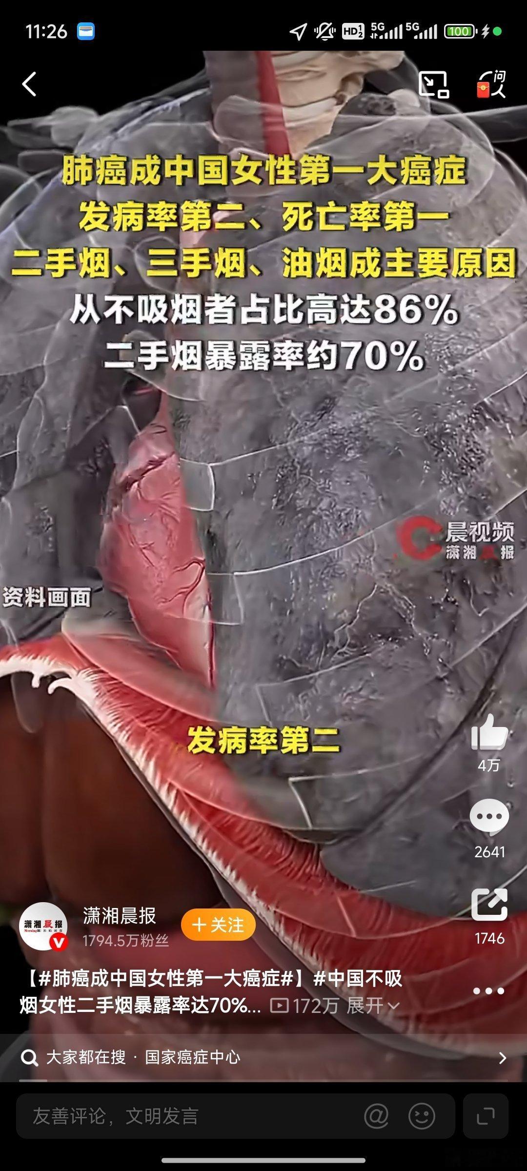 肺癌成中国女性第一大癌症这个数据太震撼，也必须敲响警钟！最新报告显示，肺癌已超越