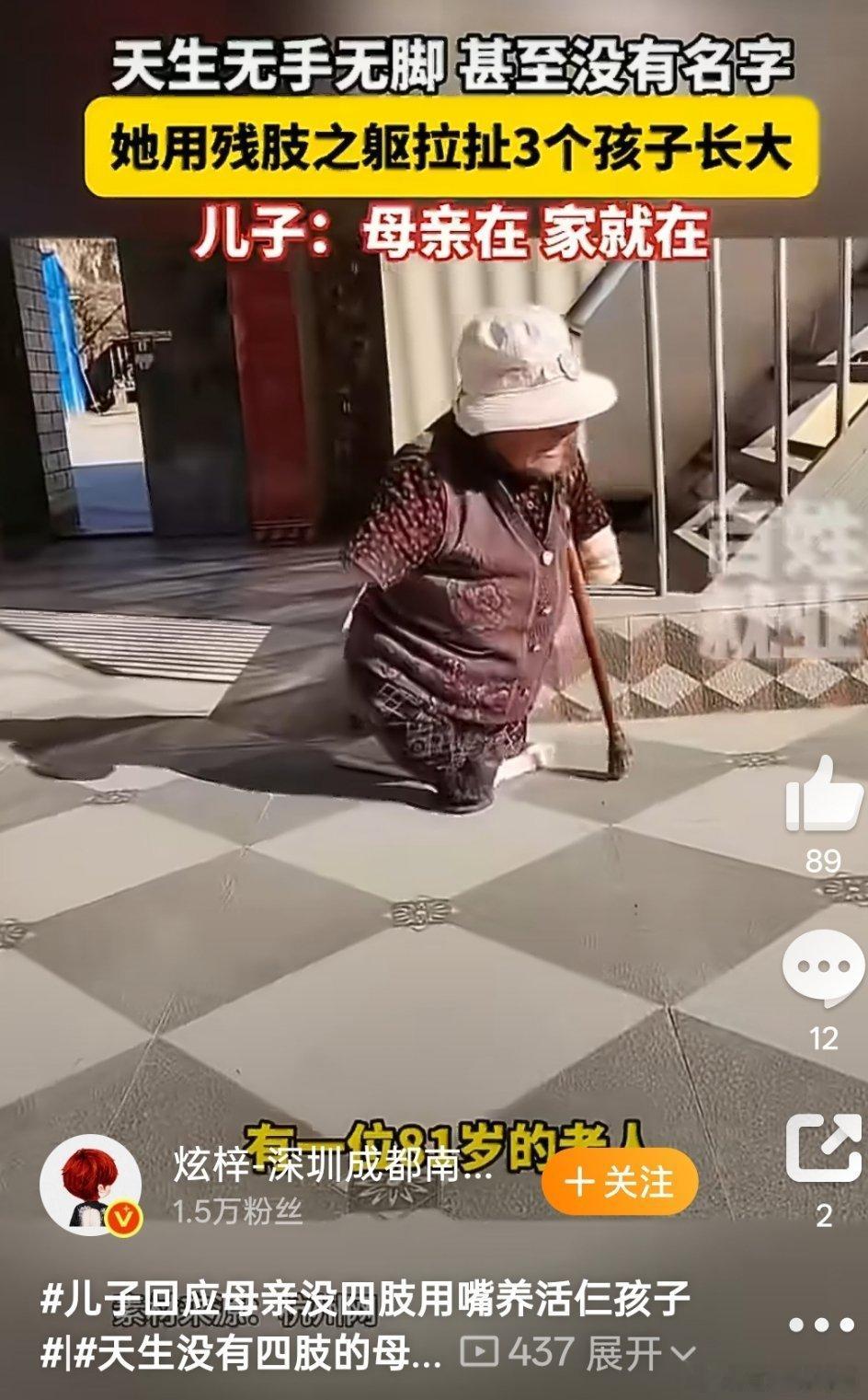 儿子回应母亲没四肢用嘴养活仨孩子额滴神呐！！！！！这样子还得生三个孩子，还要靠她