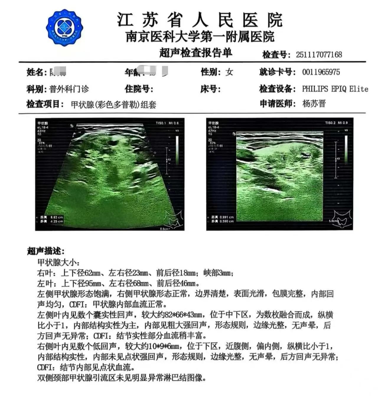 甲状腺囊肿，经一个月治疗，已经缩小一半啦～～（梅花独秀医生）散甲状腺结节
