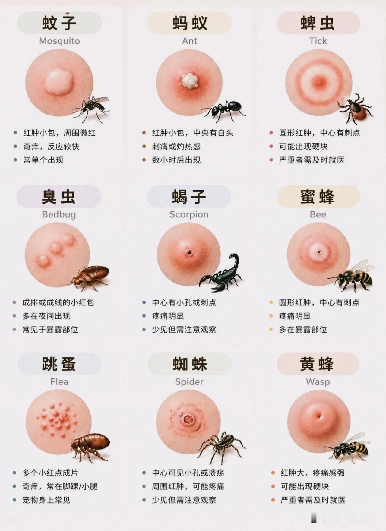 被咬起包别乱涂药膏！一张表分清9种毒虫叮咬，痒和疼原来藏着区别入夏之后浑身