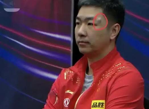 薛飞，我特地查了一下不查不知道，一查才明白他的背后教练竟然是刘恒