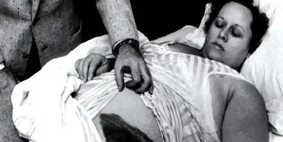 1954年，国外一女子正在睡觉中，突然感觉腹部和大腿被什么东西蹭着了一样，疼痛难