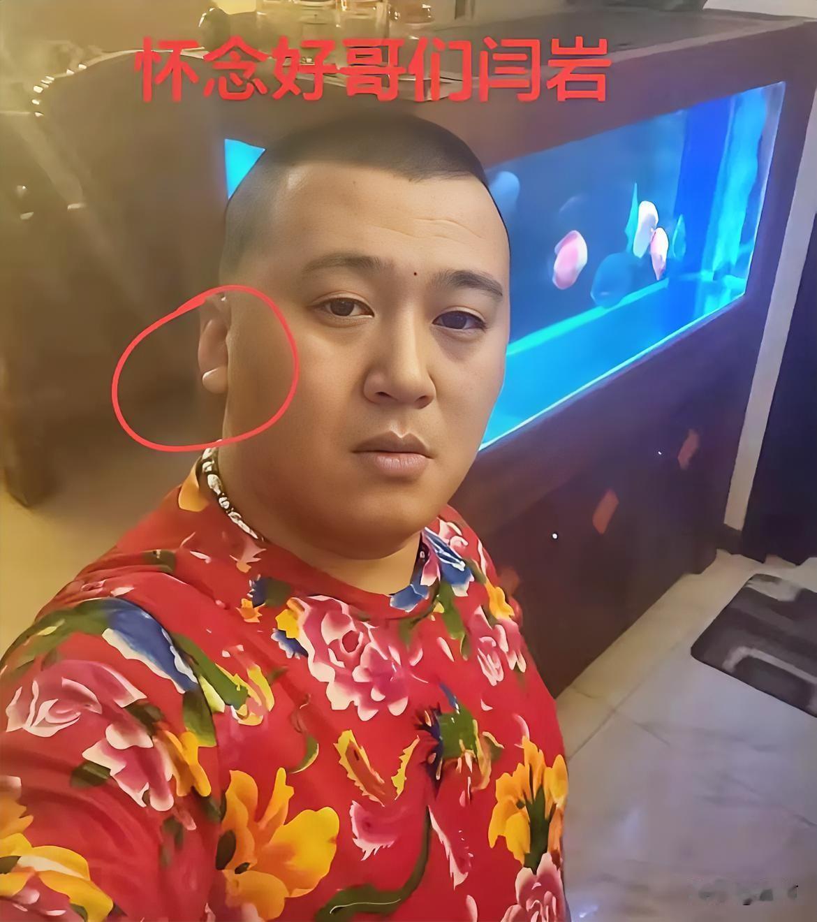 42岁天津“老炮儿”阎岩去世去世前耳朵上有折痕，嘴辰发紫去世原因是心梗。