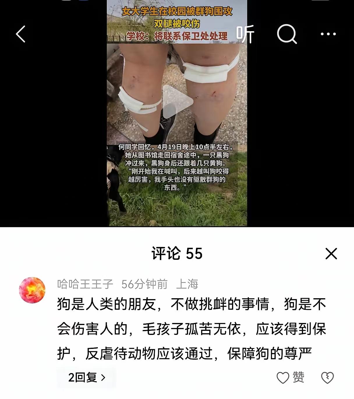 女大学生被狗咬，不去同情还胡说八道的毫无人性。这是同一所学校，当年网暴保安打狗的