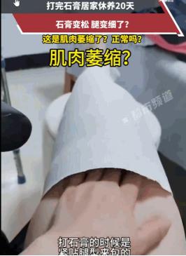 太可怕了！6月8日，山东，一女子打石膏养伤，本以为是走向康复，结果20天后差点当