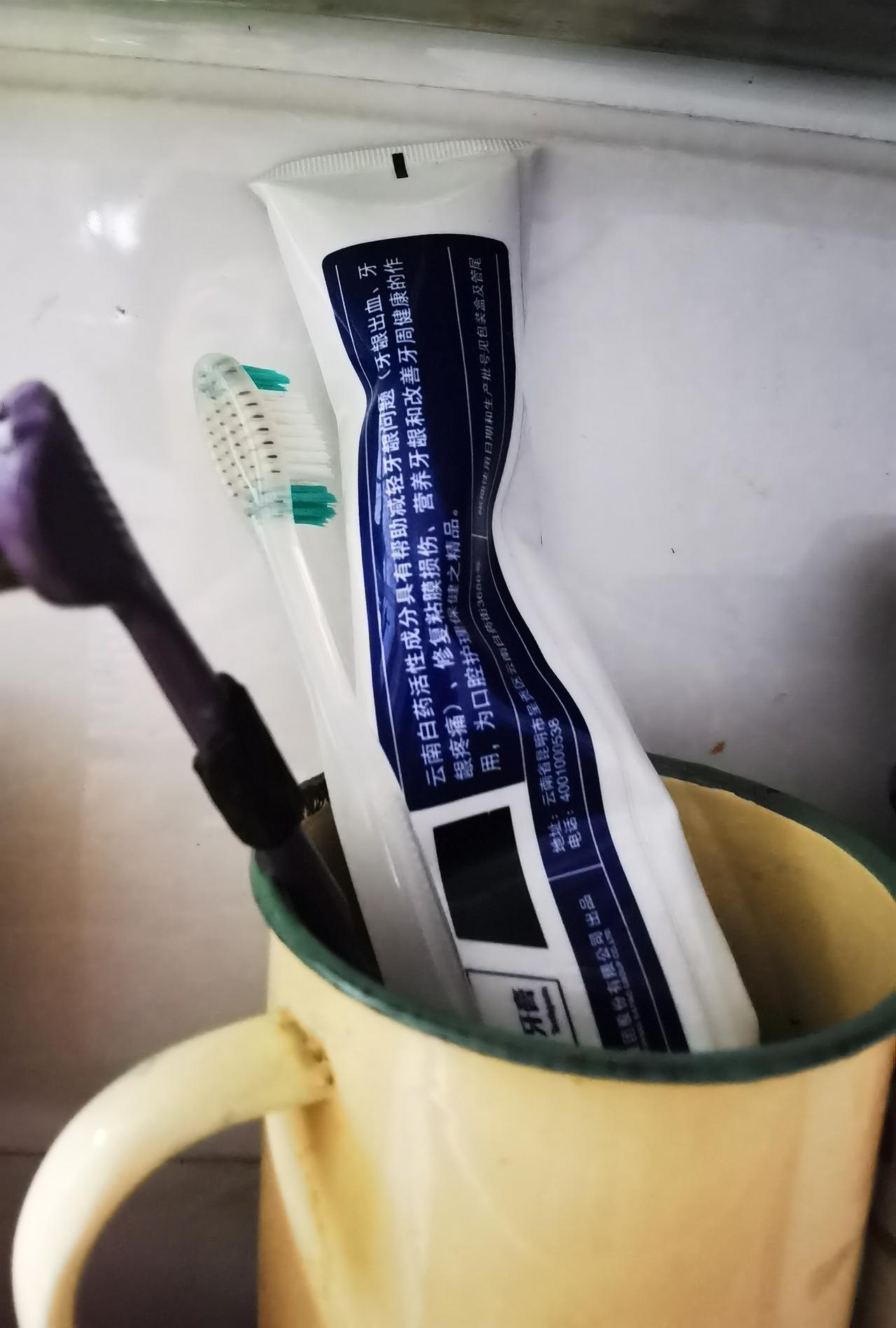 牙龈有黑三角怎么办我有两个牙有黑三角，在网上看到有牙膏能刷掉黑三角，结果买了四