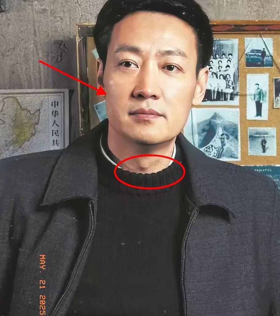 节哀！生活还要继续！