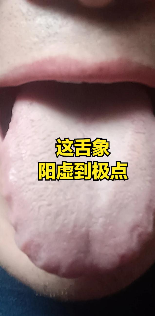 流鼻涕像关不紧的水龙头？你可能补错方向了今早地铁上隔壁小哥的抽纸声比报站声还响