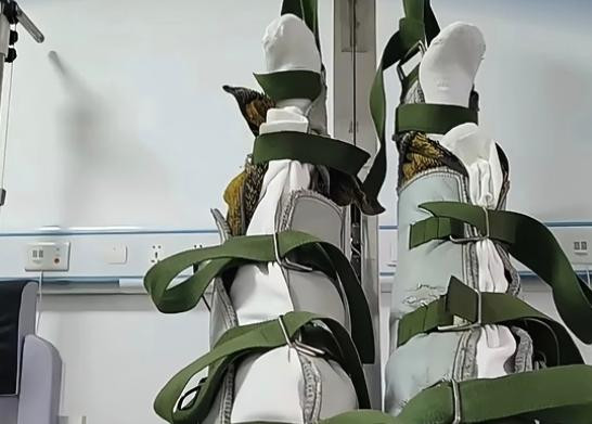 #卫健局回应双腿被吊1小时无人应答#【贵州仁怀卫健局回应“患者双腿被吊超1小时”