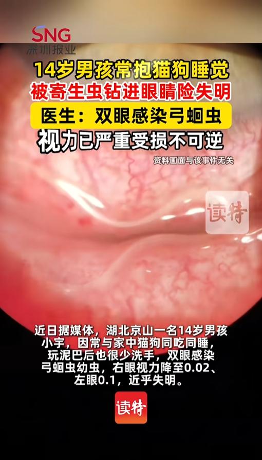 “悲剧还是发生了！”近日，湖北京山，一位14岁的男孩经常和猫狗一起同吃同睡，平时