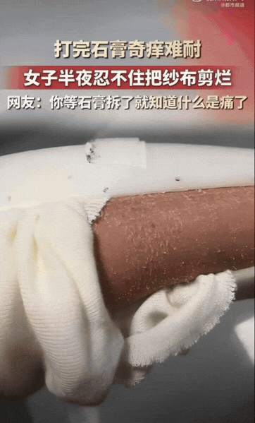 陕西一位女子胳膊受伤打上石膏，石膏包裹在胳膊上，闷在里面又痒又难受，夜里实在扛不