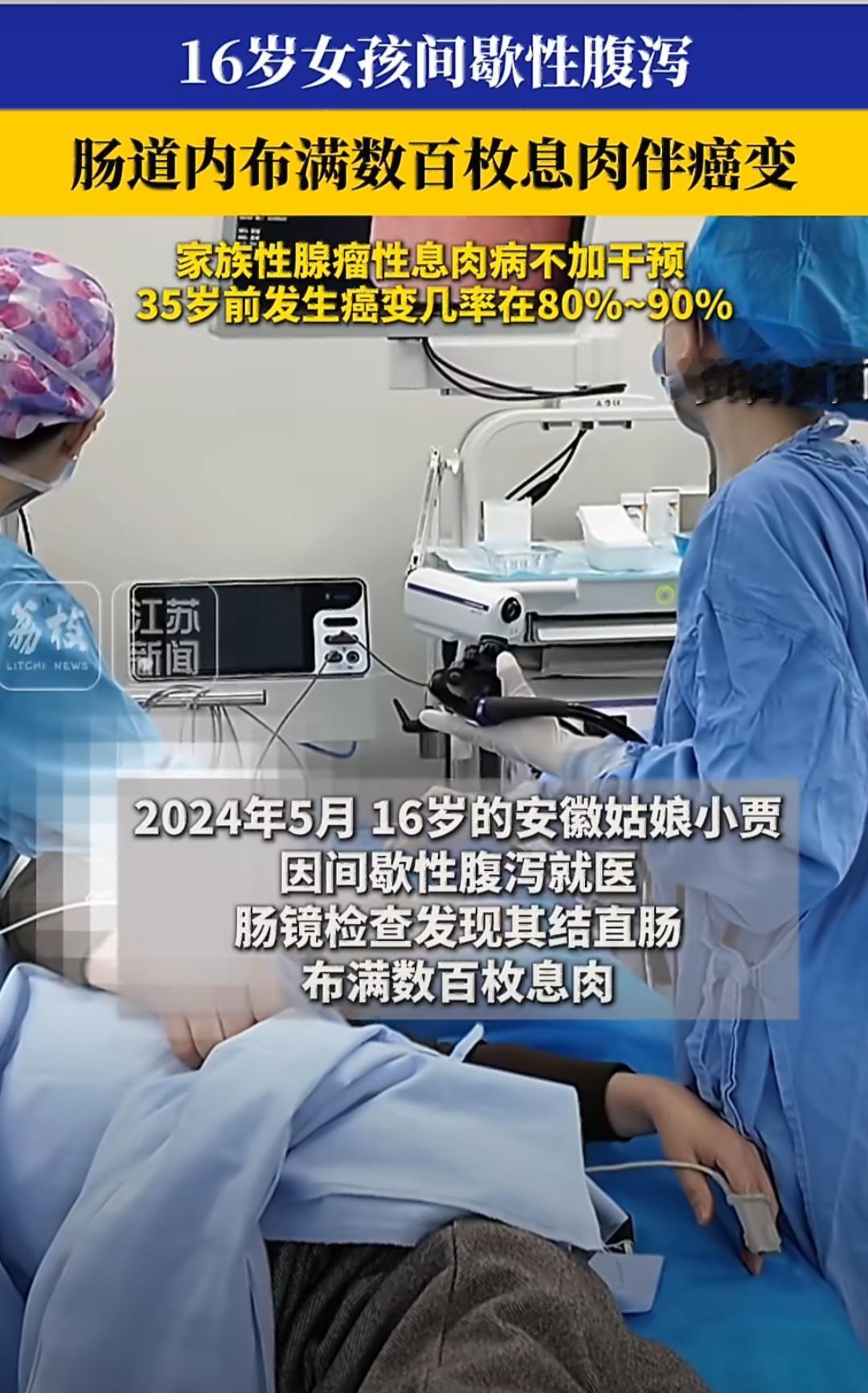 安徽有个16岁的姑娘小贾，平时老是间歇性腹泻，就去医院看病。医生给她做肠镜检查，