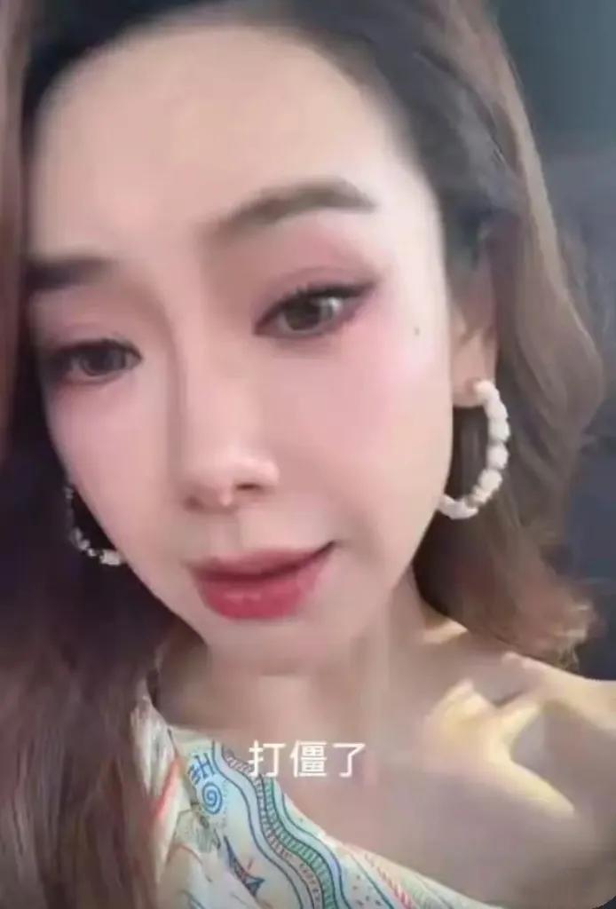 戚薇直播掀刘海自证“打僵了”：当医美翻车现场秒变脱口秀！看，眉毛焊死了！睁眼全