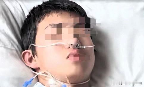 回家准备后事吧！黑龙江17岁少年董立仁因胸口刺痛就医，X光片显示胸腔藏4根金属异