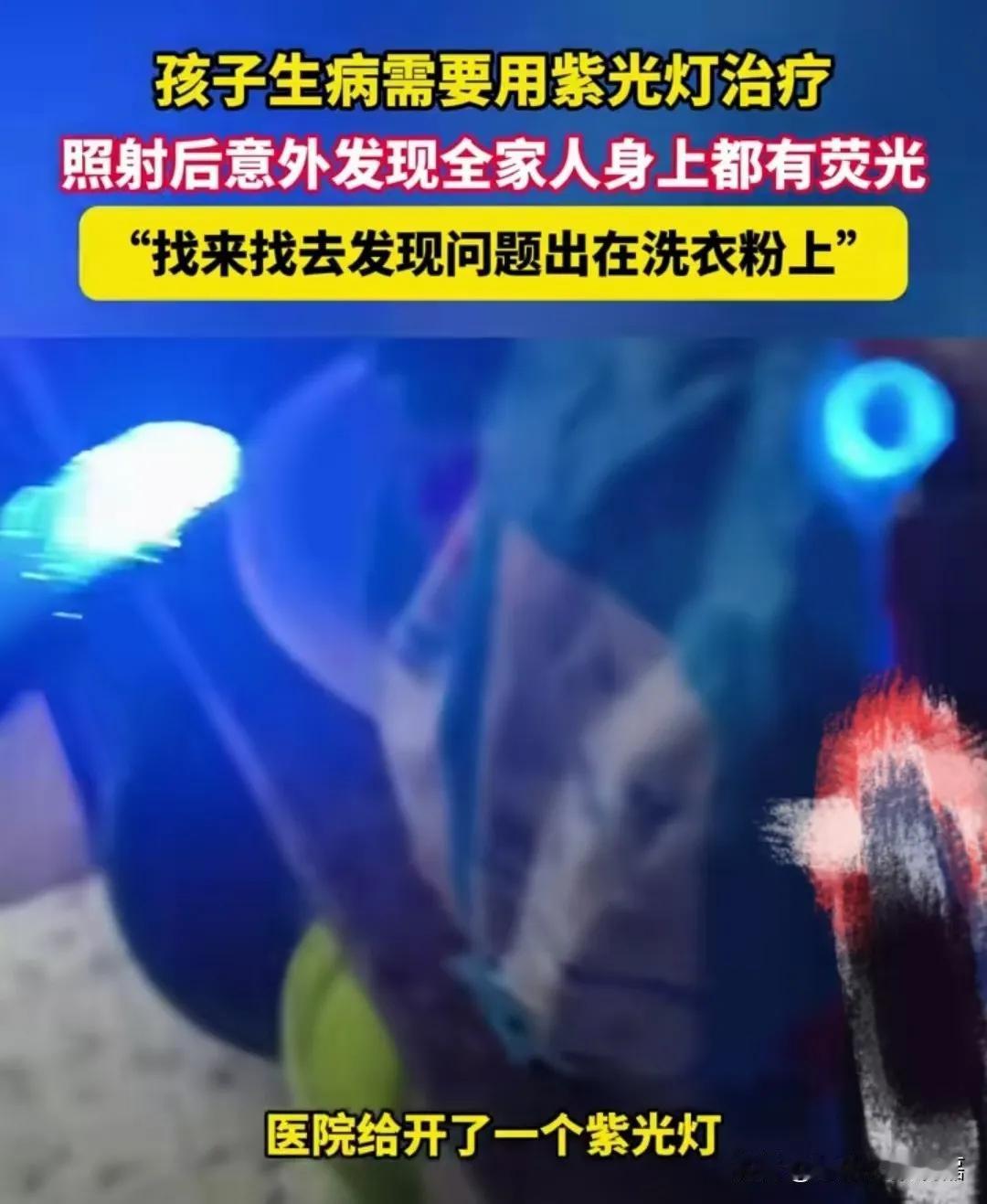 浙江温州，孩子确诊白癜风，需要用紫光灯治疗，妈妈照射后意外发现全家人身上都有荧光
