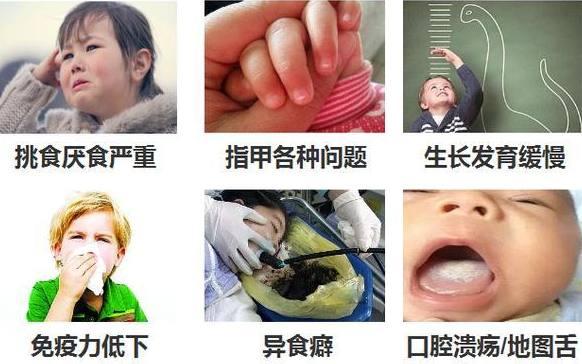 宝宝缺锌会有哪些症状?