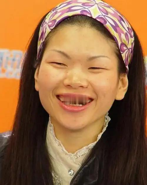 1999年，吕燕18岁，带着满脸雀斑去面试模特，一个男人看到她说:“你真漂