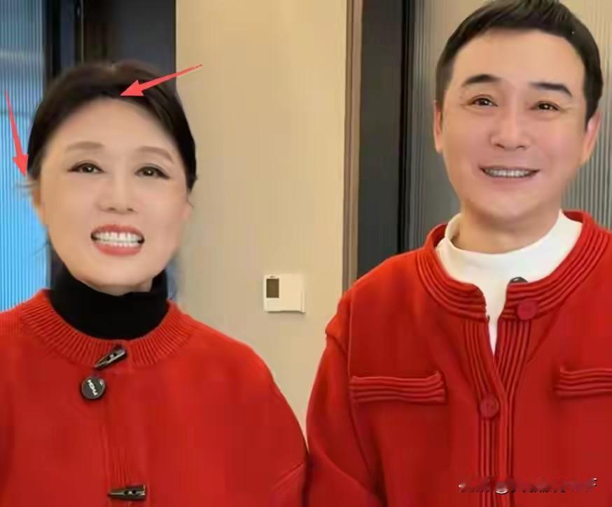 64岁的黄梅戏表演艺术家、国家一级演员吴琼，为顾及49岁丈夫阮巡的感受，特意戴上