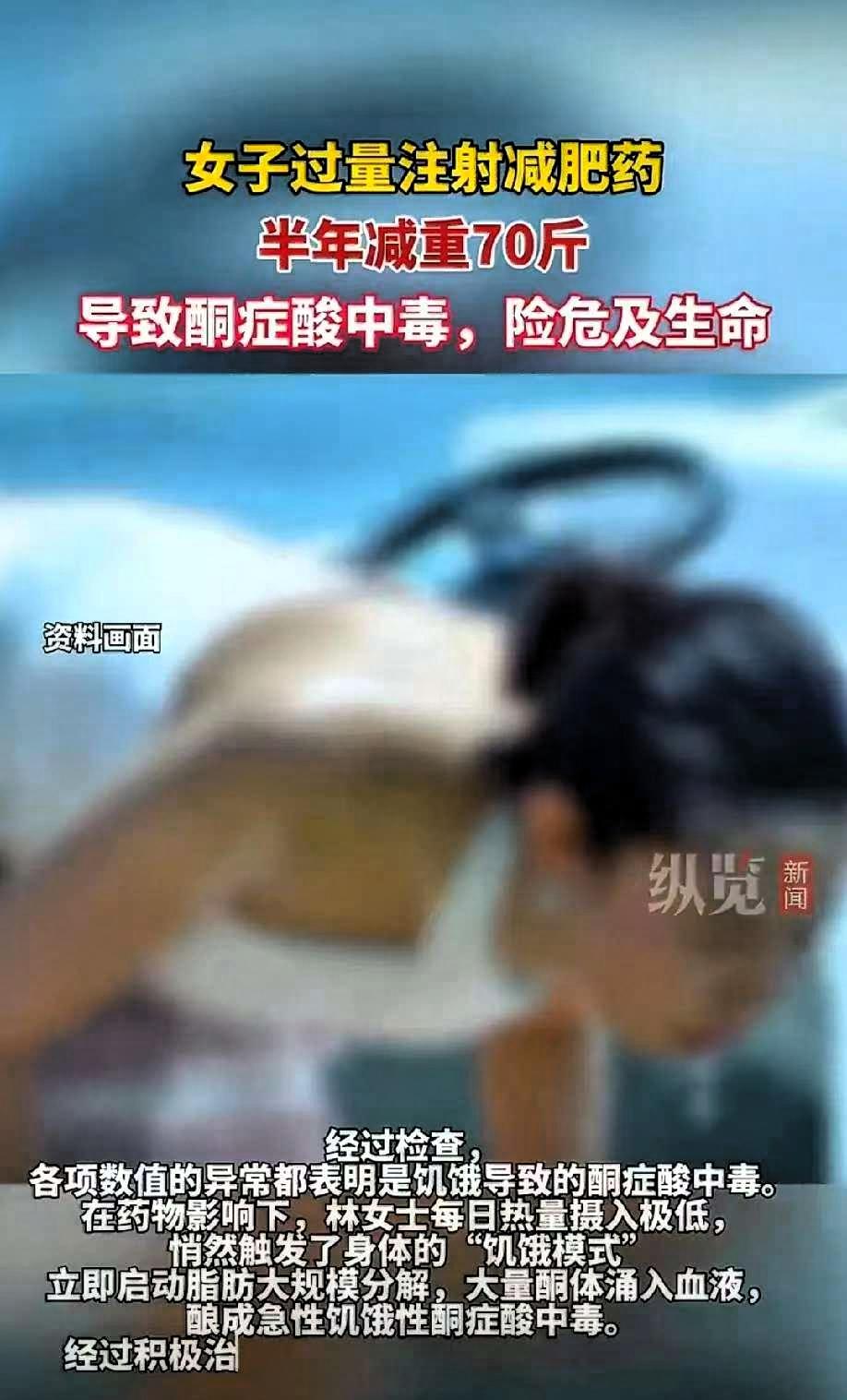 太惊心了！浙江林女士为了快速瘦下来，自行注射网红减肥药，半年内从160斤猛降到9