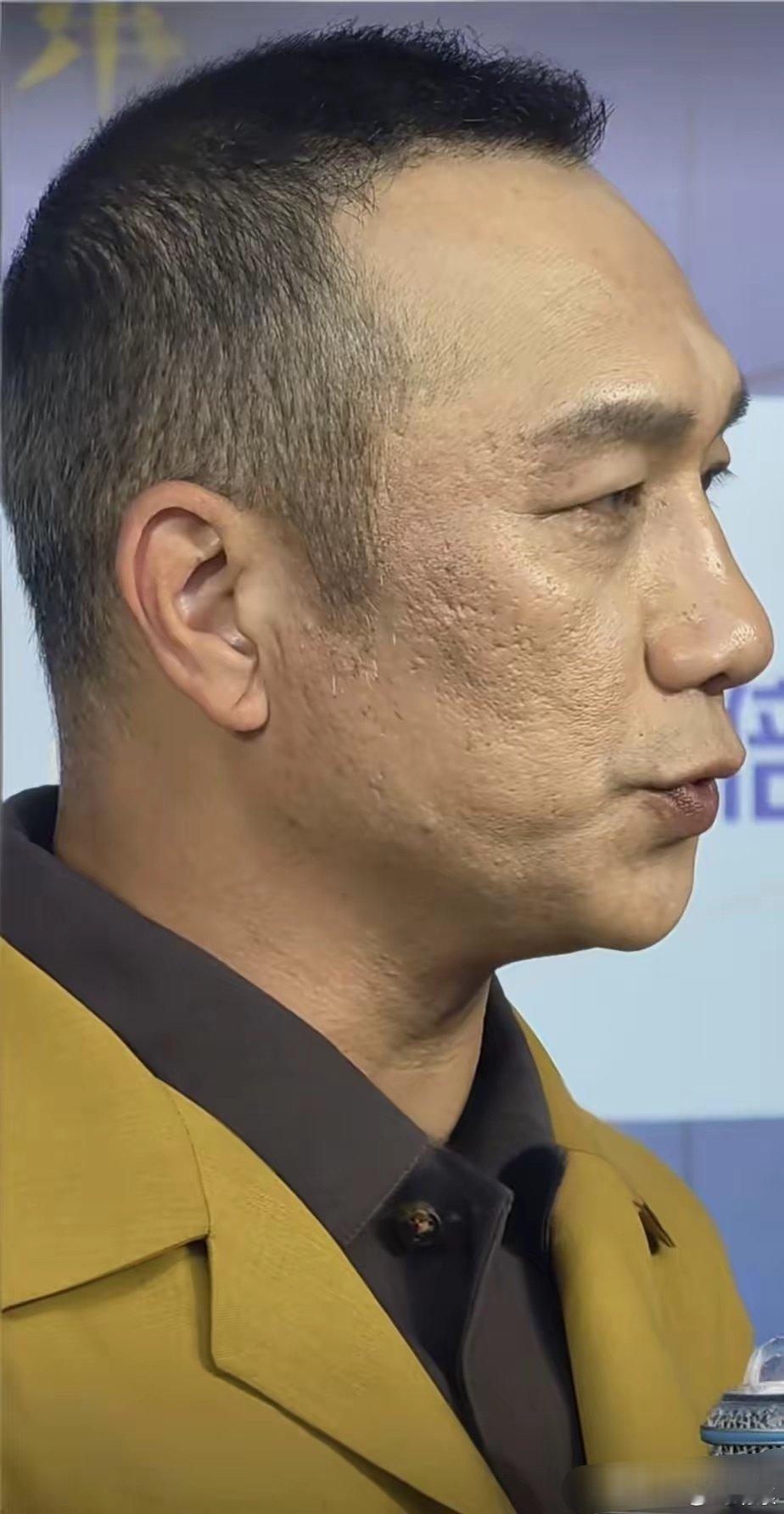 不是说明星都很会保养吗？怎么这皮肤看着比普通人还要粗糙