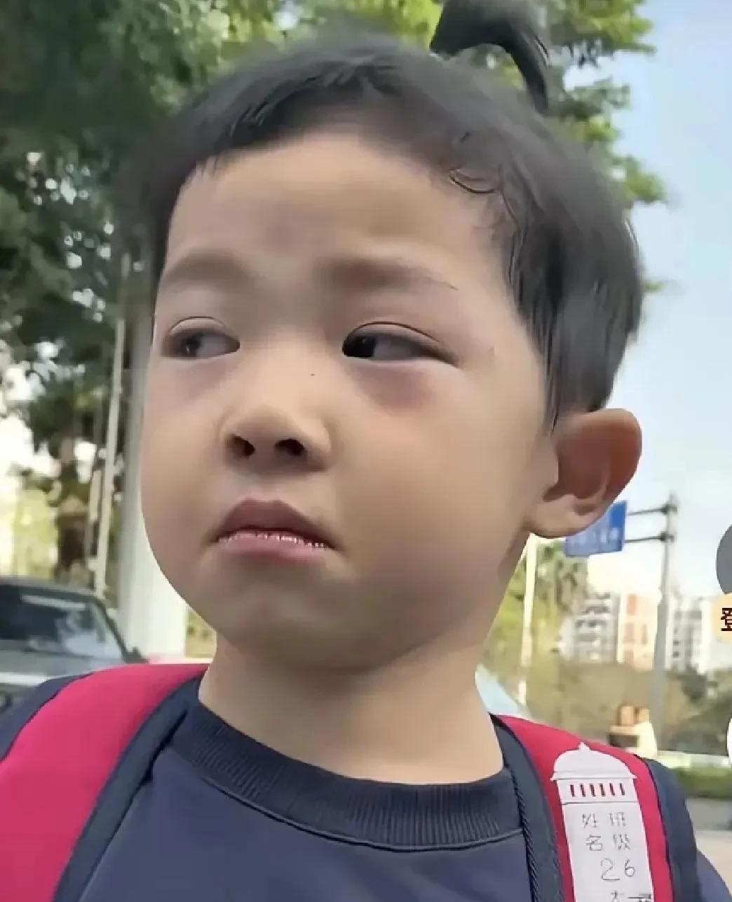 可怜的小天使，最终还是被选择了孤独！因为74岁高龄的父母健康状况日渐衰退，小天赐
