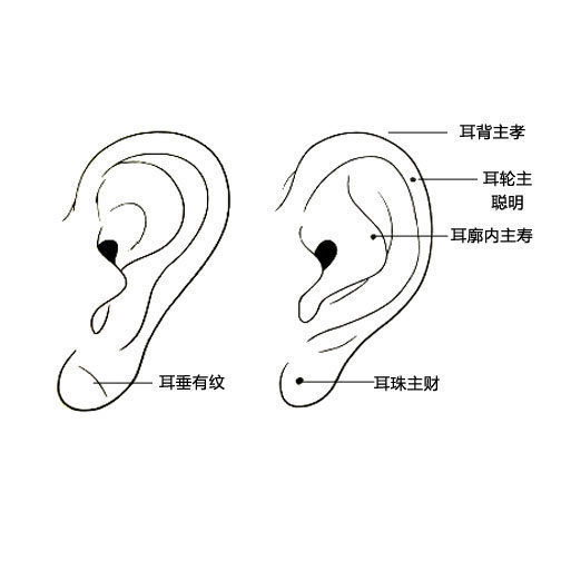 耳朵上的痣不要总看到痣就说不好，像有一些痣是吉痣来的；面有面相，耳有耳相，今天就以耳朵的痣为案例。耳