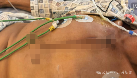 四川一男子在自家窗边遭枪击受重伤, 官方: 已抓获4人