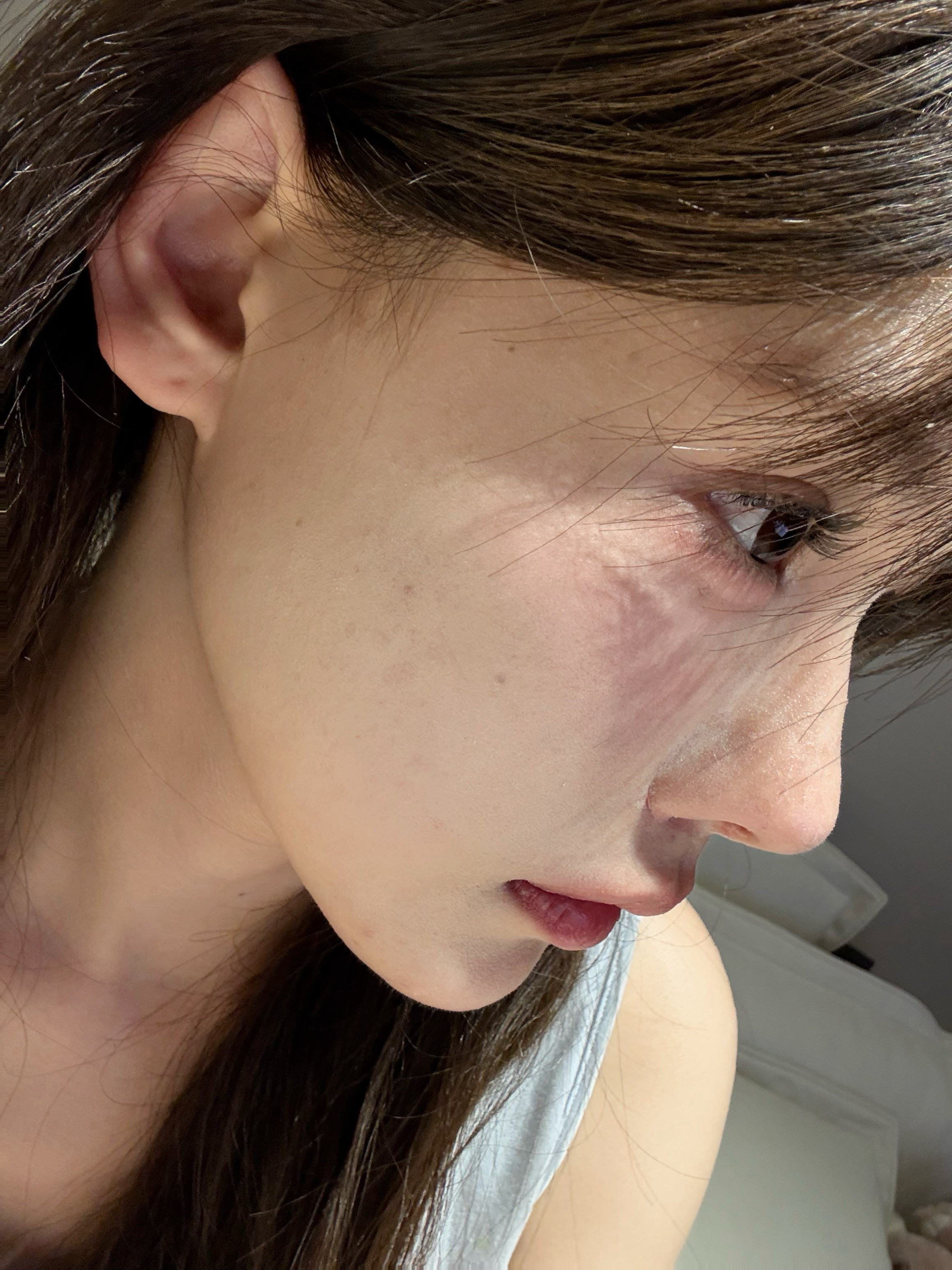 做完鼻子第三次化妆为什么鼻子卡粉这么严重啊感觉都是皮而且鼻头很大烦死了只