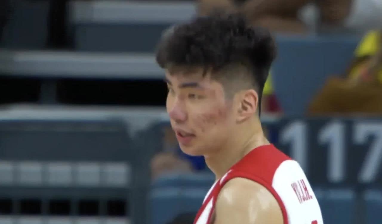 余嘉豪的脸，到底怎么啦？晚上看中国男篮与委内瑞拉男篮的热身赛，镜头给了余