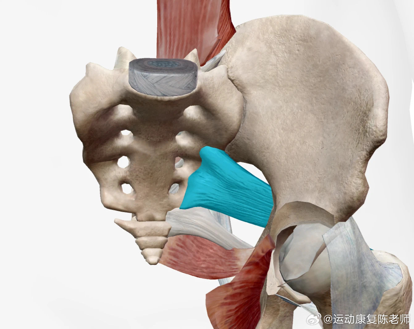 梨状肌综合征臀部、大腿、小腿有放射痛，很多朋友会以为自己是腰椎间盘突出，但实际