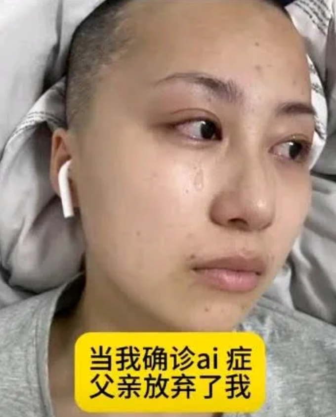 遭父弃的26岁女孩，孤身抗癌前行