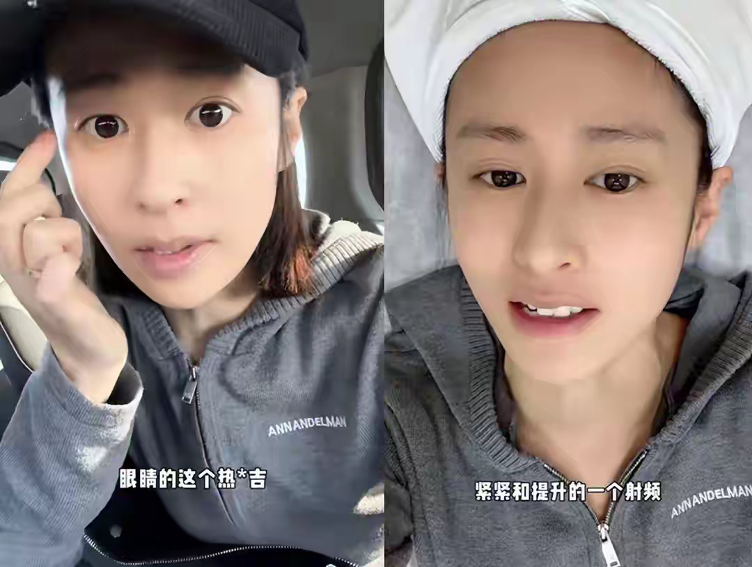 37岁颖儿疼哭了，花大几万做热玛吉改善川字纹，花钱遭罪也值得