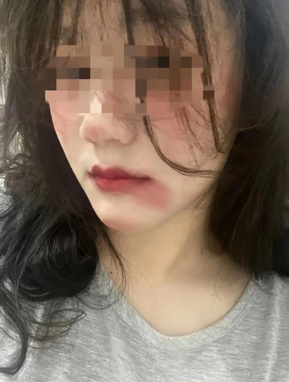 女子吐槽说，她结婚第一天被丈夫打了，这一打把她的心打碎了，她不会和丈夫再过了，心