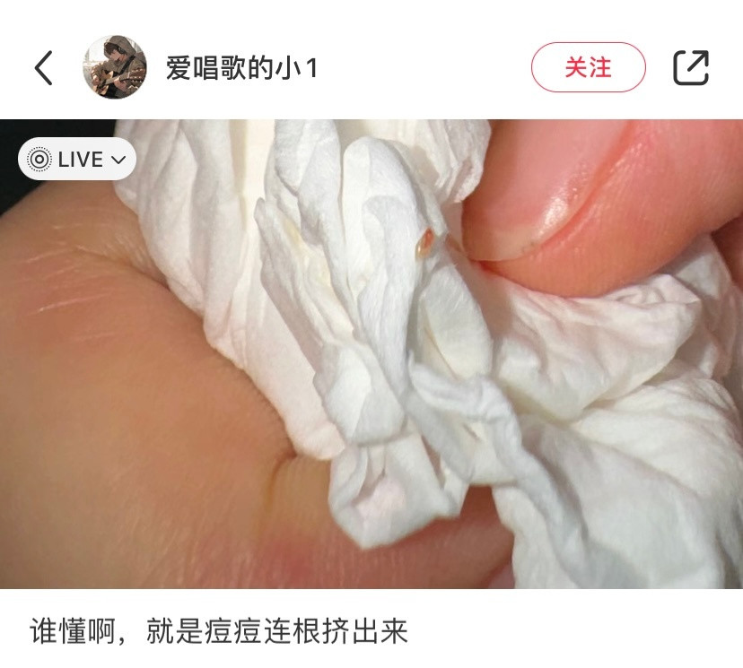 谁懂啊，就是痘痘连根挤出来​​​