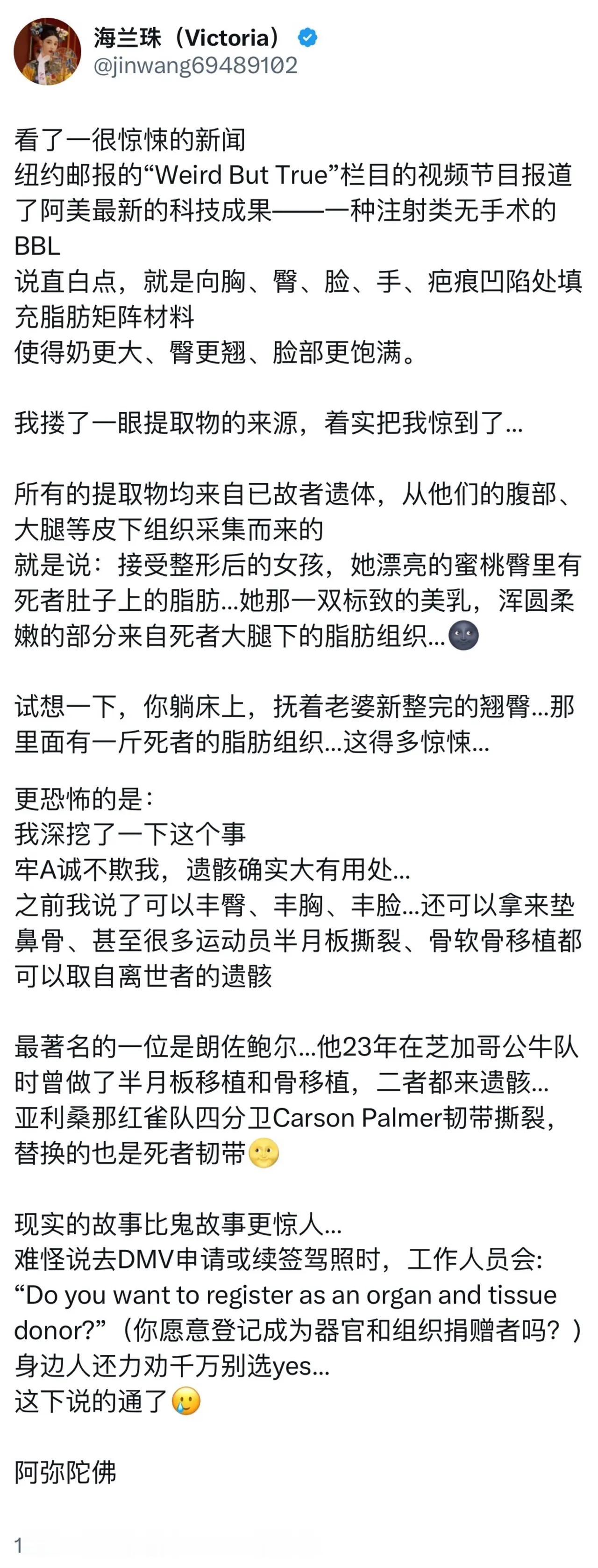 原来牢A说的是真的啊，这也太颠覆认知了吧！《纽约邮报》都做了公开报道，并称之为阿