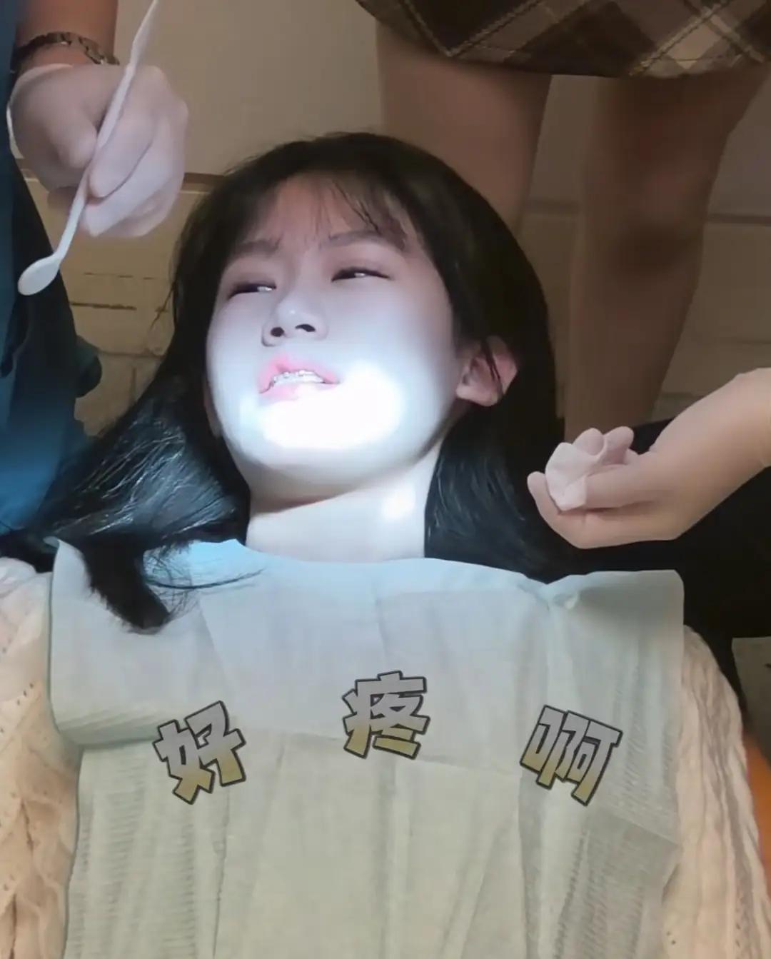 陆毅鲍蕾发布了他们的大女儿贝儿矫正牙齿结束，剪牙套的视频。视频中贝儿痛得流泪，陆