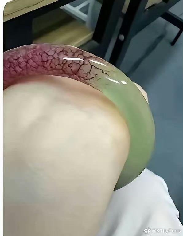 婆婆送的镯子没带多久，就成这样了，怎么办