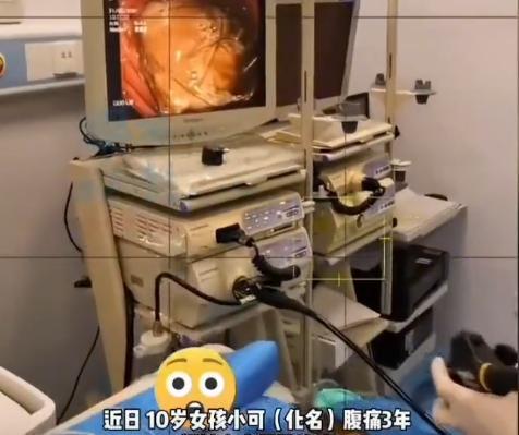 “活久见！”2025年9月，福建，一10岁女孩腹痛3年，到医院一查，竟然发现她的
