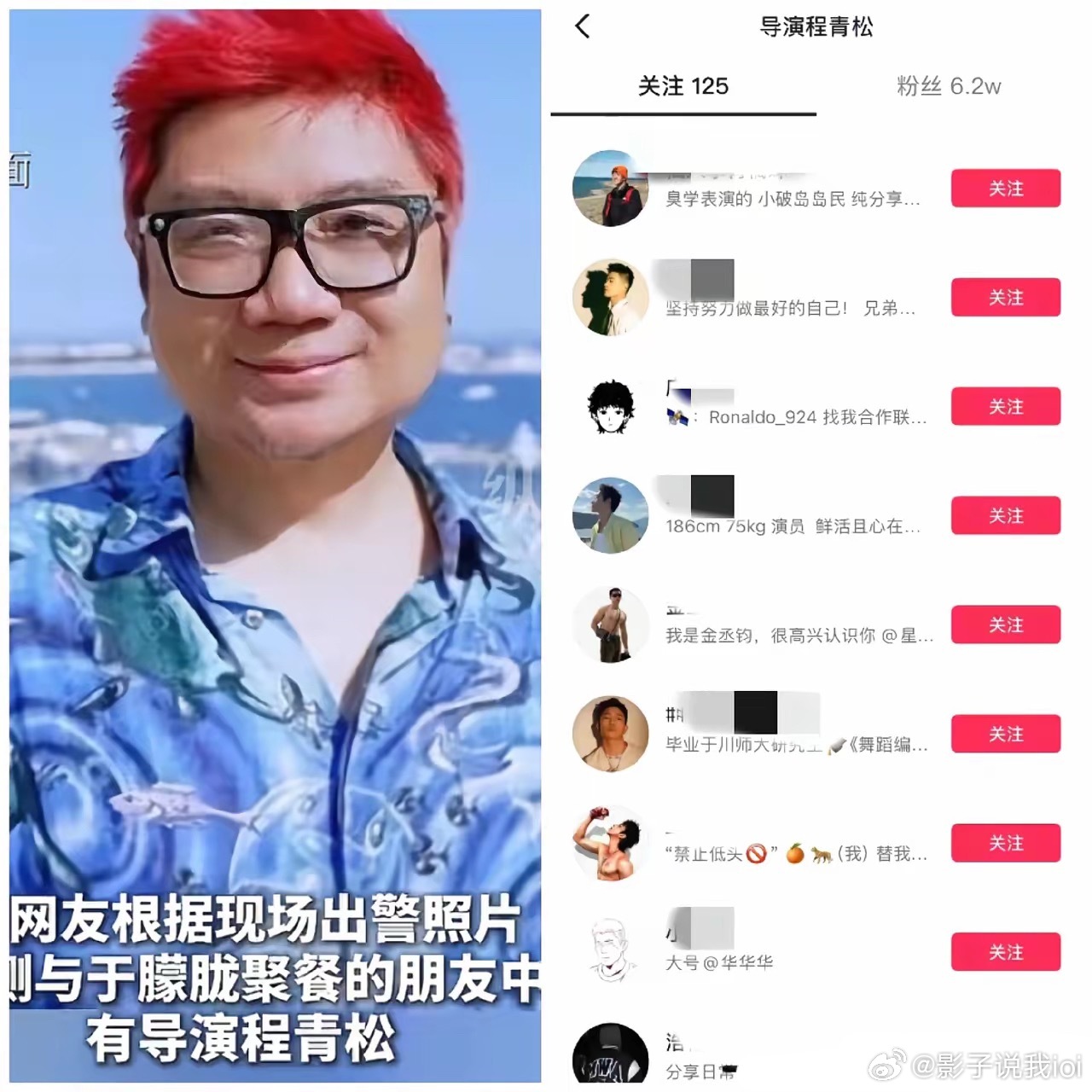 于朦胧这事，导致陈青松关注列表曝光，大部分是美男子，长相帅气，不亚于于朦胧。​之