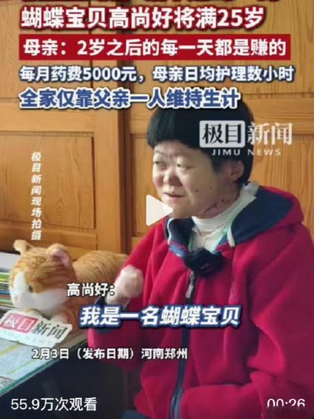 被断言活不过2岁的蝴蝶宝贝将满25岁2001年被医生断言“活不过两岁”的高尚好如