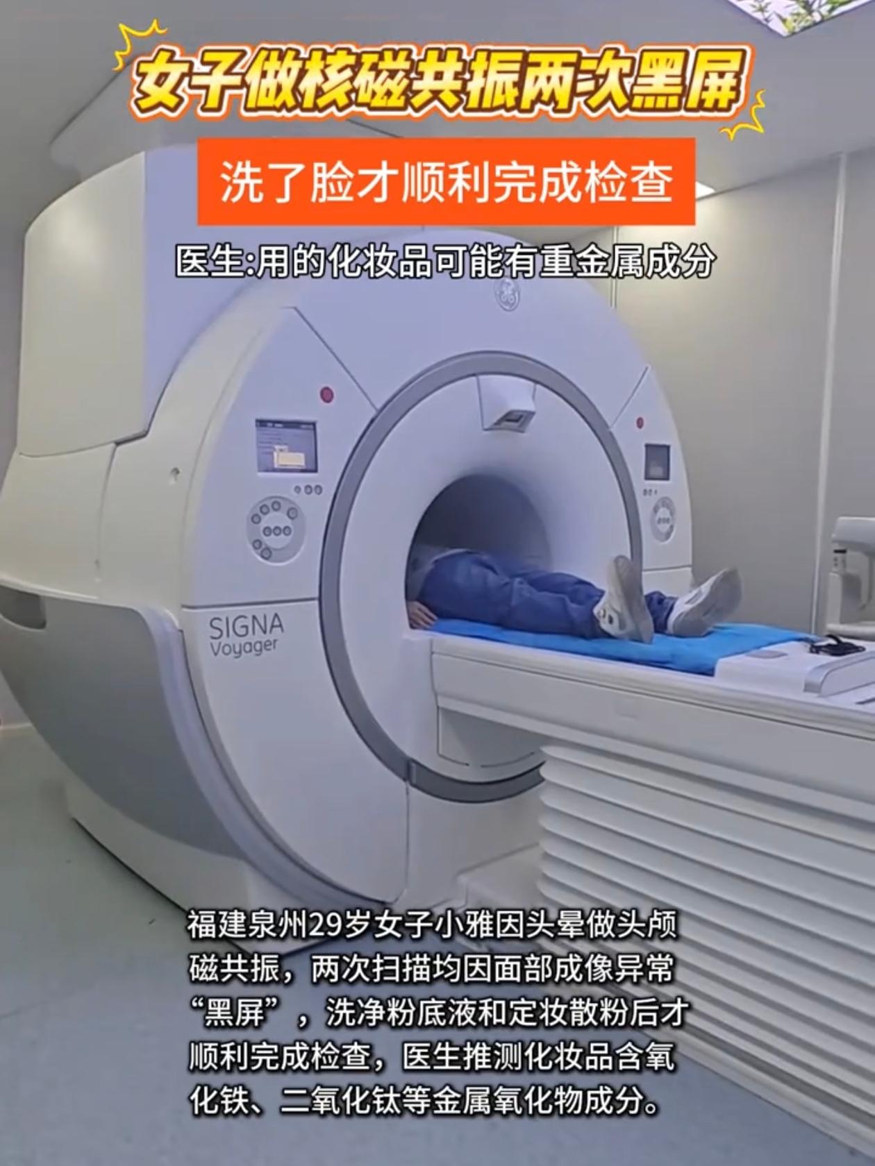 福建29岁女生小雅去医院做头颅核磁检查，机器开起来成像模糊，医生停下来再试一次，